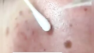 GROWING SKIN REMEDY ♥️♥️♥️