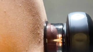 Chinese Cupping Therapy at Home