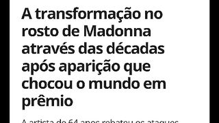 Cantora popular fez cirurgia plástica e ficou irreconhecível