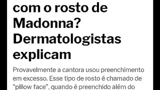 Cantora quer processar médicos por erro na cirurgia plástica