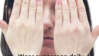 Melasma: A Guide to Understanding Treatment