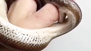 جب سانپ نے کاٹا تو جسم کا رنگ کیسے بدلا