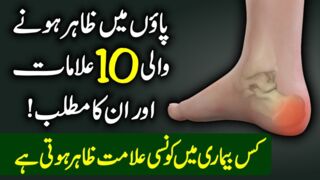 10 Foot Symptoms And Their Meaning - 10 Signs Of Disease Your Feet Can Reveal Urdu Hindi