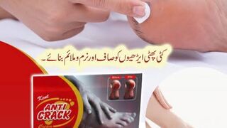 Treatment of cracked heels with homeopathic cream.