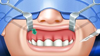 {ASMR} Jaw Surgery Animation