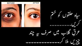 Aankhon k halky khatm karny k lea (for dark circles)