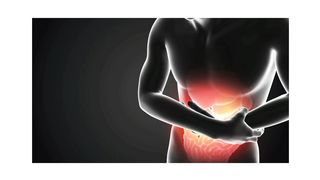 Human stomach ulcer and Gastric ulcer