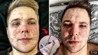 Тима мацони попал в больницу- что случилось?