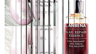 Fungal Nail Repair Essence Serum Care Finger Toe