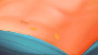 Ingunial Hernia Surgery-Surgery ASMR Animation