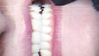 oral hygiene
