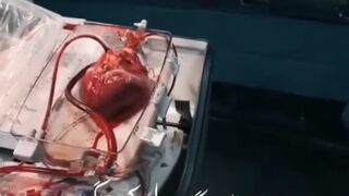 band ho jay kab dil ke dharkan 2 ghari ka bhar