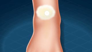 {ASMR} Ankle Replacement Recovery