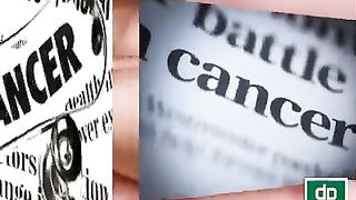 Free Cancer ka ilaaj Pakistan main 2023 | Cancer treatment in Pakistan |