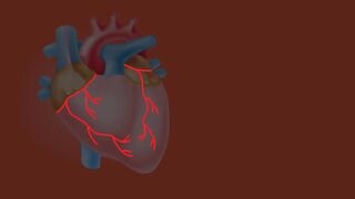 Heart coronary  issues