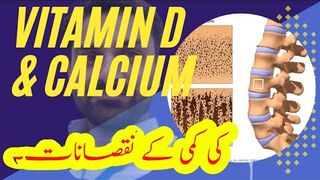 Calcium and Vitamin D deficiency part 1 2023