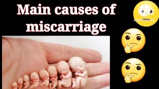 Causes of miscarriage | preventions of miscarriage