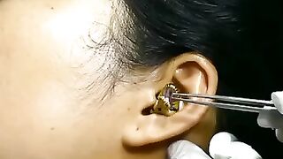 SNAKE IN GIRL EAR