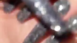 Surgery
