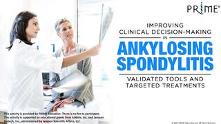 Ankylosis spondylitis