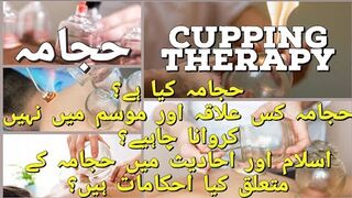 What is Cupping Therapy in Islam? | اسلام میں حجامہ کیا ہے؟