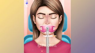 ASMR Broken Nose Bone Surgery | Animated surgery operation