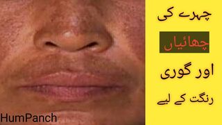 Pigmentation Remedy By Humpanch