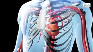 Angioplasty