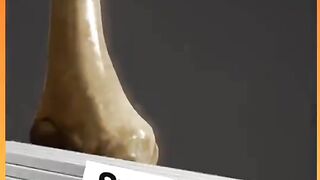 Humman boons || Insan ki haddi Allah ki qudrat dekho