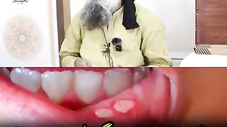 Mooh may chalain Mouth Blister causes