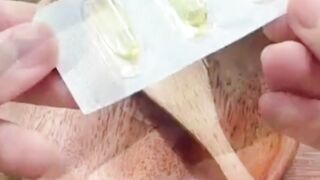 Vitamin E use as a night cream
