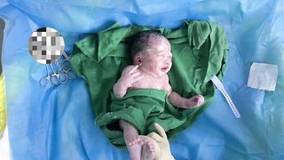 Baby delivery