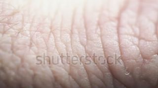 Dr. Zee__1 Absolute Best Remedy for Dry and Wrinkled Hands