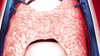 How Thyroid Gland Is Removed #Shorts #youtubeshorts #viral #transformationvideo #trending #video1231