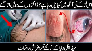 Creatures Found LIVING INSIDE The Human Body
