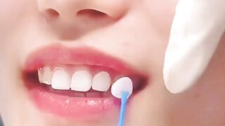 Teeth whitening chinese tips
