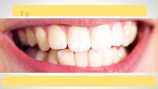 10 Des Meilleurs Moyens Pour Naturellement Blanchir Tes Dents à la Maison