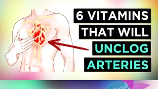 Unclog ARTERIES 6 vitamins