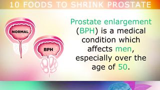 Shrink prostate 10 foods