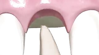 Tooth_Implant_Procedure_{STEP_BY_STEP}