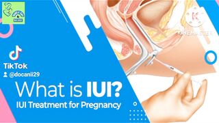 Intrauterine Insemination