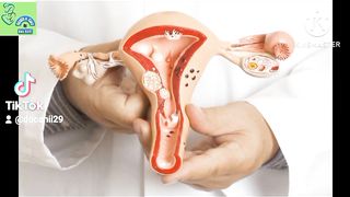 Ovarian cyst & Treatment in Urdu