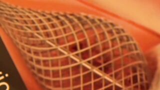 Removes Blood clots
