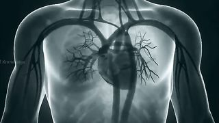 Heart_Attack__Mayocardial_Infarction____Symptoms%2CCauses_And_Treatments__Urdu_Hindi_