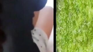 How To Increase Hair Growth