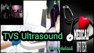 what is TVS Ultrasound