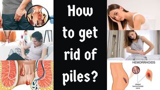 permanent cure of Piles