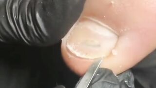 Most satisfying Nail Cleaning Videos Compilation