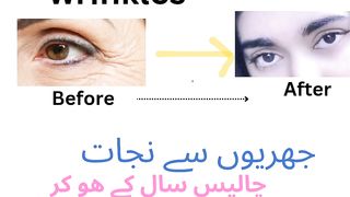 How to get rid of Wrinkles,,