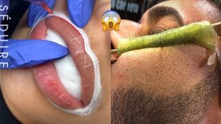 Most Extreme Beauty Treatments 2